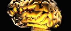 neurologia-sao-jose-de-ribamar-1380115673